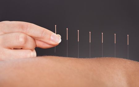 Akupunktur Vorarlberg by Dr. Heike Flatz